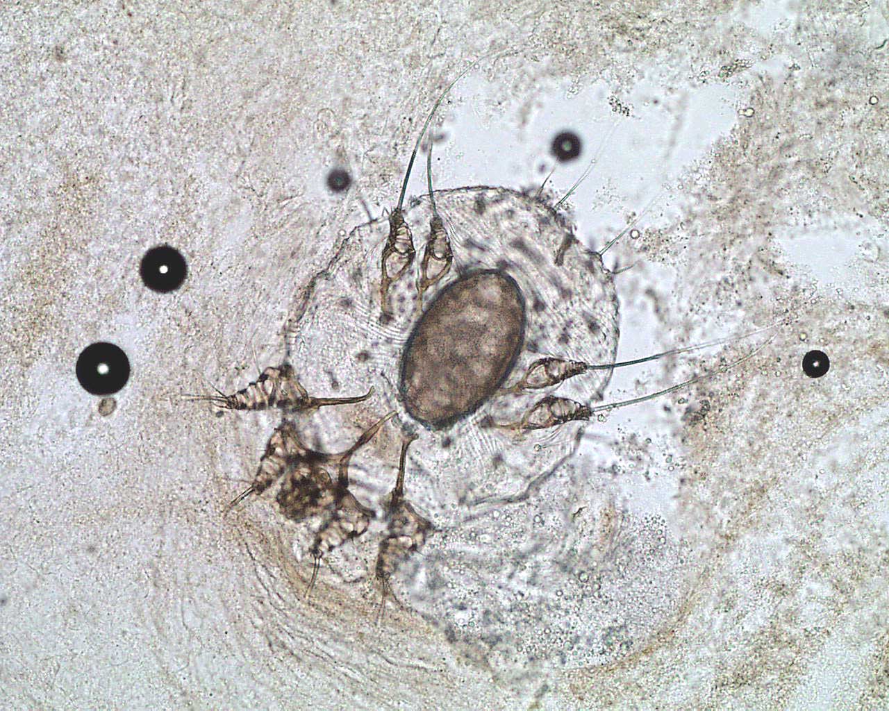 scabies1.jpg (244898 oCg)